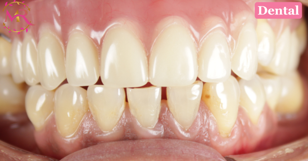 Dentures treatment