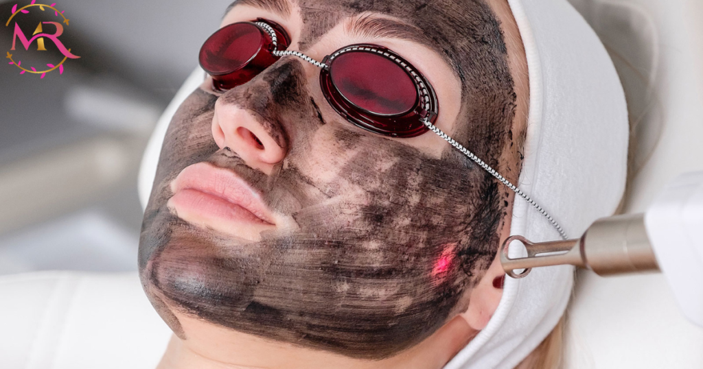 Carbon Laser Treatment – Barsha heights Dubai