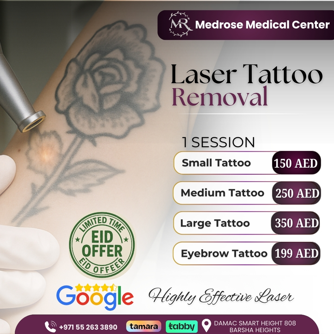 laser tattoo removal offer