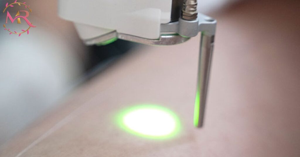 Full Body Laser Hair Removal in Dubai – UAE