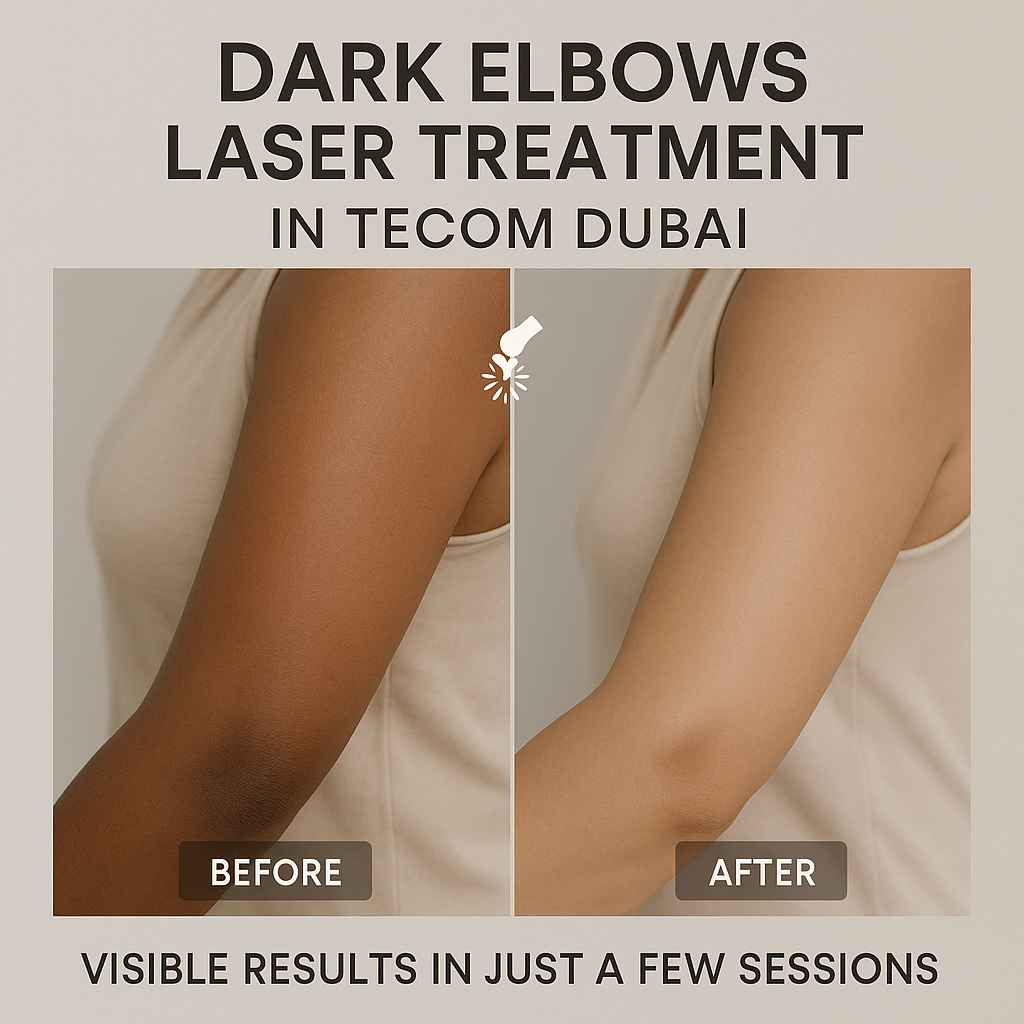dark knees laser treatment