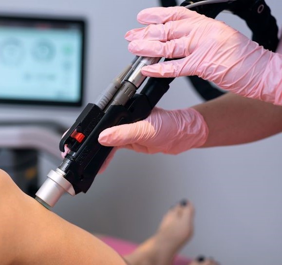 Deka Again Laser hair removal