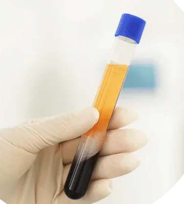 PRP