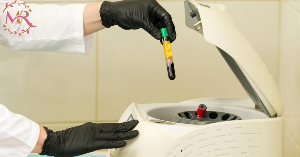 PRP Treatment in Dubai – Natural Rejuvenation for Skin & Hair