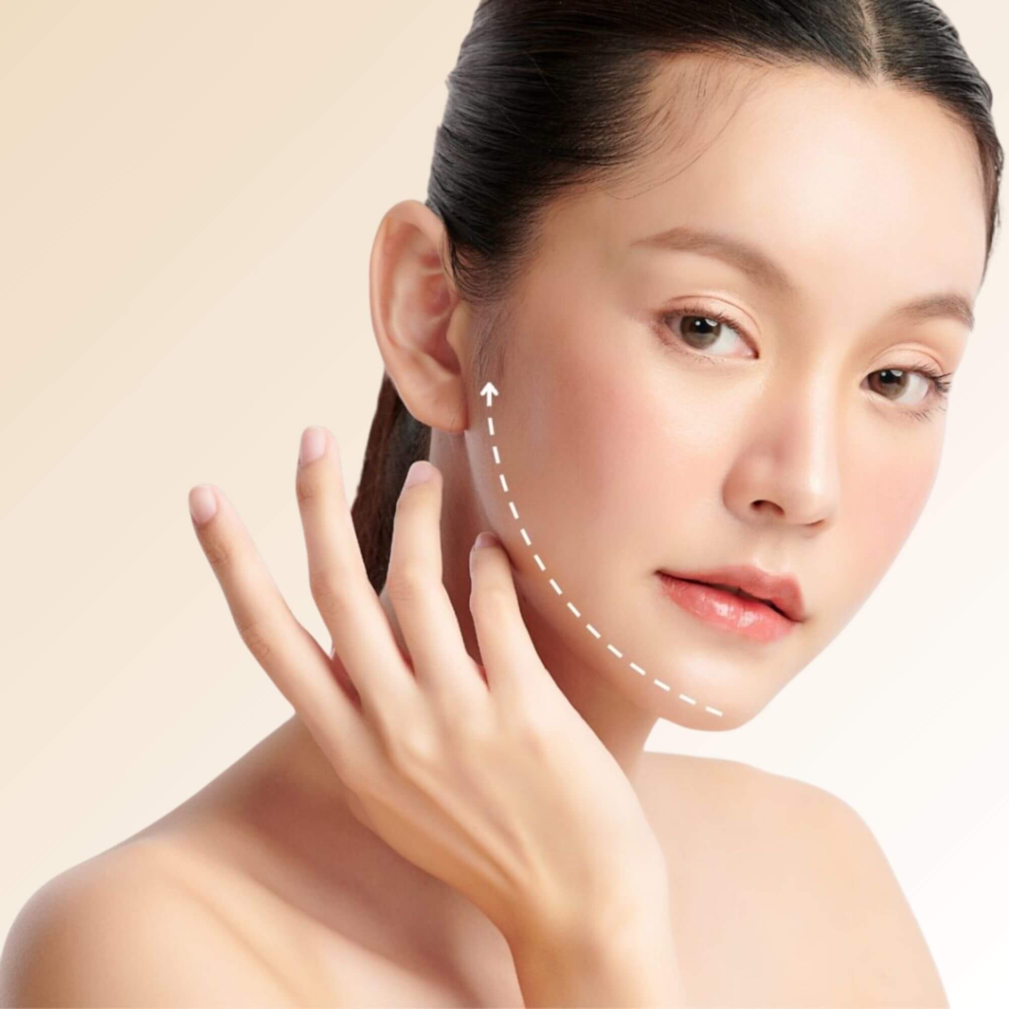 Microneedling RF