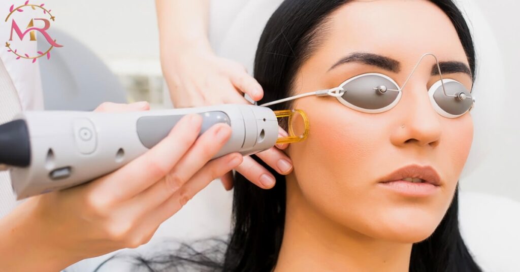 Facial Laser Hair Removal in Barsha Heights, Tecom Dubai