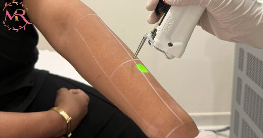 Laser Hair Removal in Dubai – Effective for Men and Women