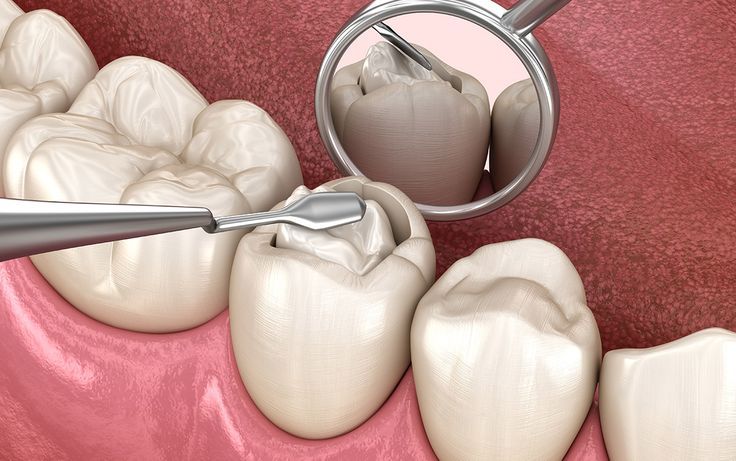 Restorative dental treatments at Medrose Medical Center