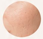 Skin texture and elasticity