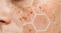Skincare products and skin treatment
