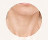 Crepey skin appearance