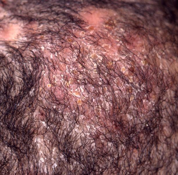 Hair and scalp close-up