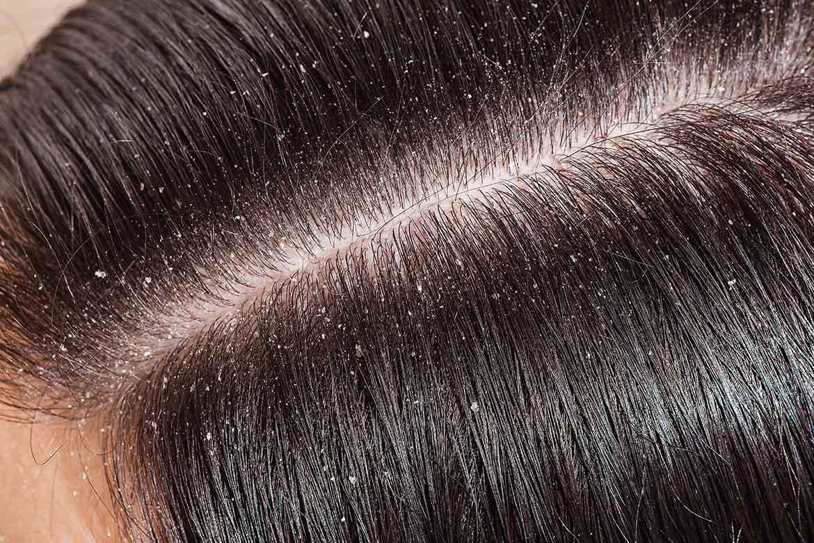 Close-up skin texture