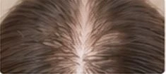Hair viewed from above