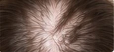 Scalp and hair close-up