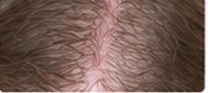 Scalp and hair close-up