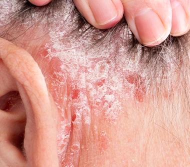 Dermatology skin detail